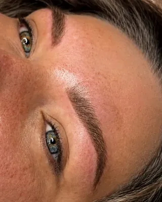 Healed brows on fair skin, seen from the side