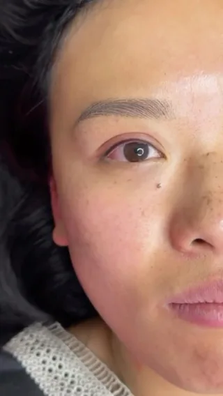 Healed lash line enhancement, portrait