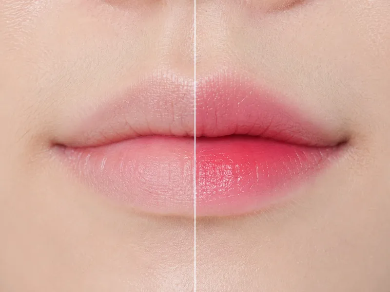 Korean style lip tint, untreated lip on the left and the healed result on the right